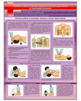 Стенд "Отработка приемов сердечно-легочной реанимации на тренажере-манекене"